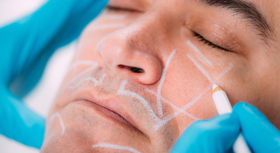 Facial contouring has become increasingly popular in the world of aesthetic treatments.