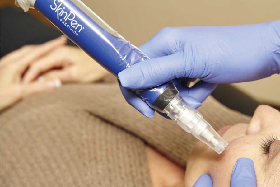 SkinPen Microneedling